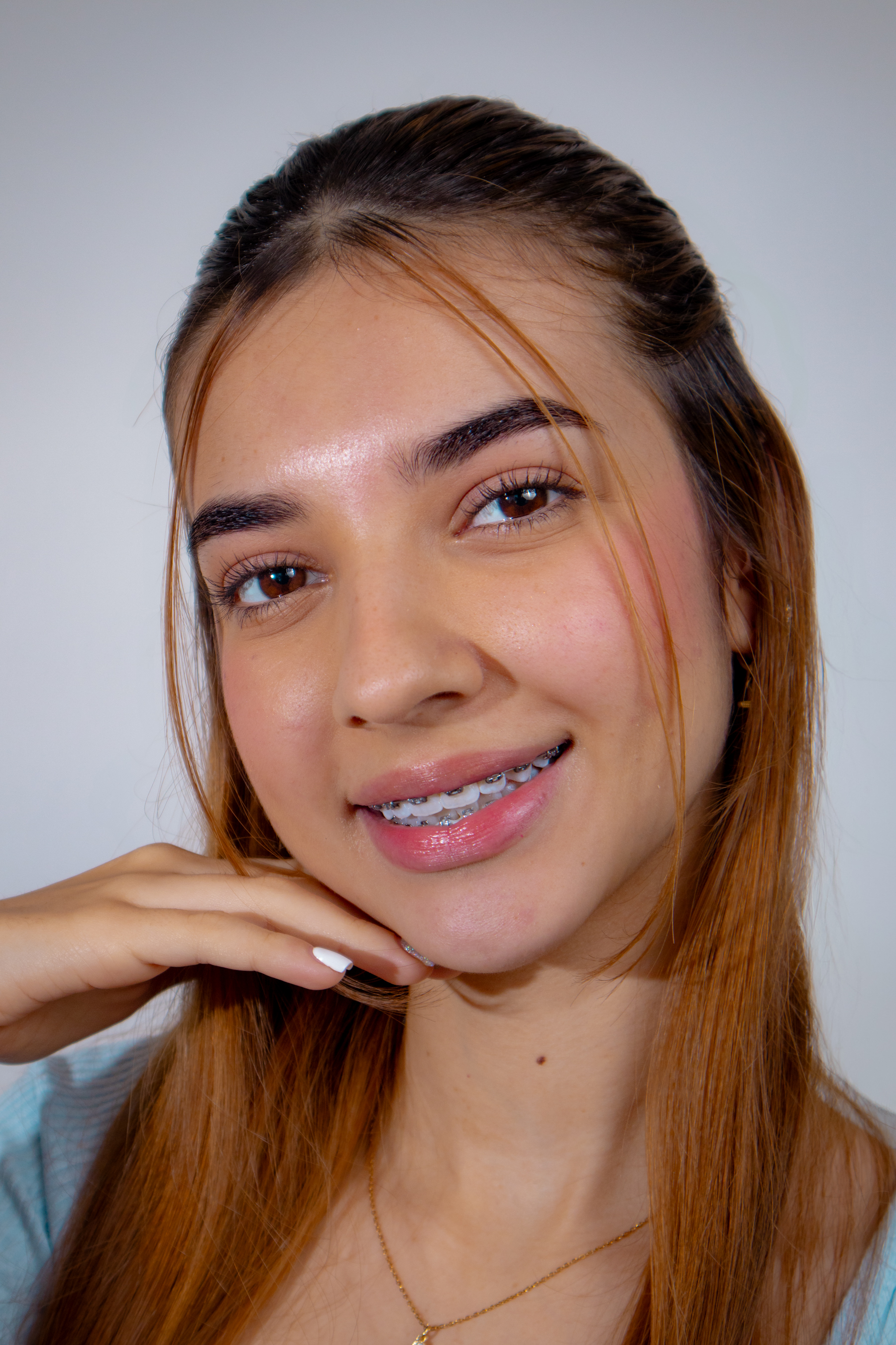 Paciente con brackets metálicos convencionales